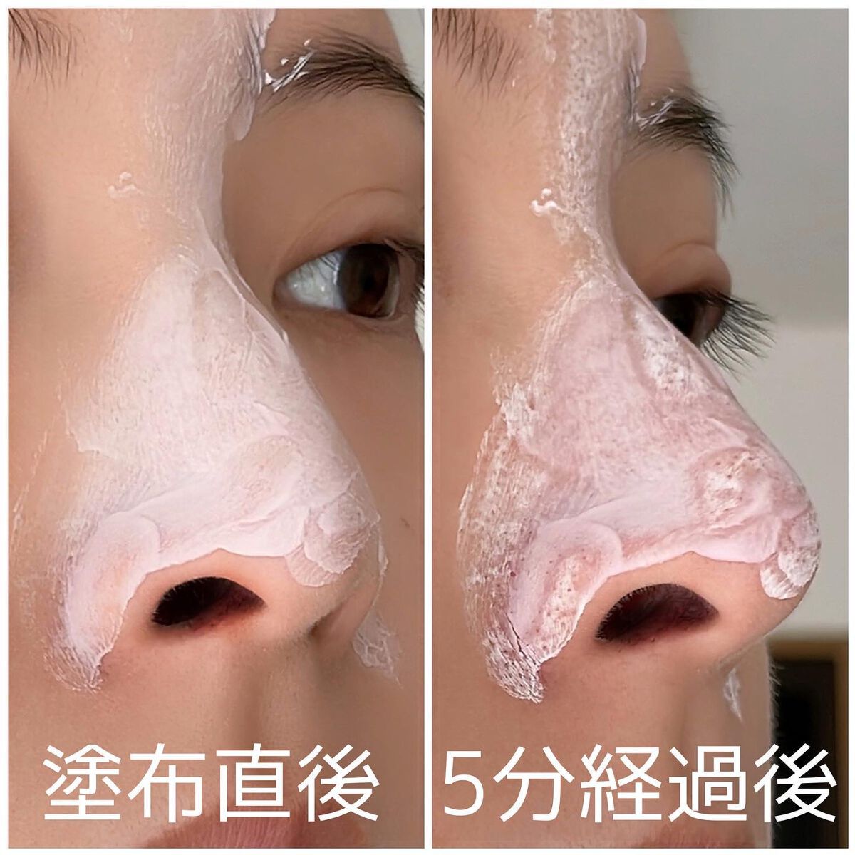 フレッシュドットパック/ももぷり/洗い流すパック・マスクを使ったクチコミ（3枚目）