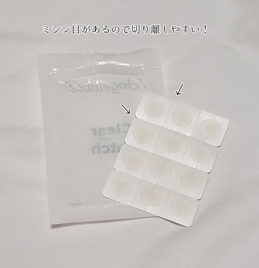 クリアパッチ/Angelab/にきびパッチを使ったクチコミ(3枚目)