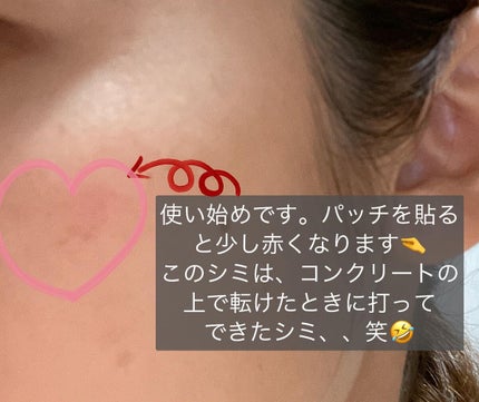 ananamargaret on LIPS 「メディキューブディープビタCパッチのご紹介です💕¥1,320(..」(6枚目)
