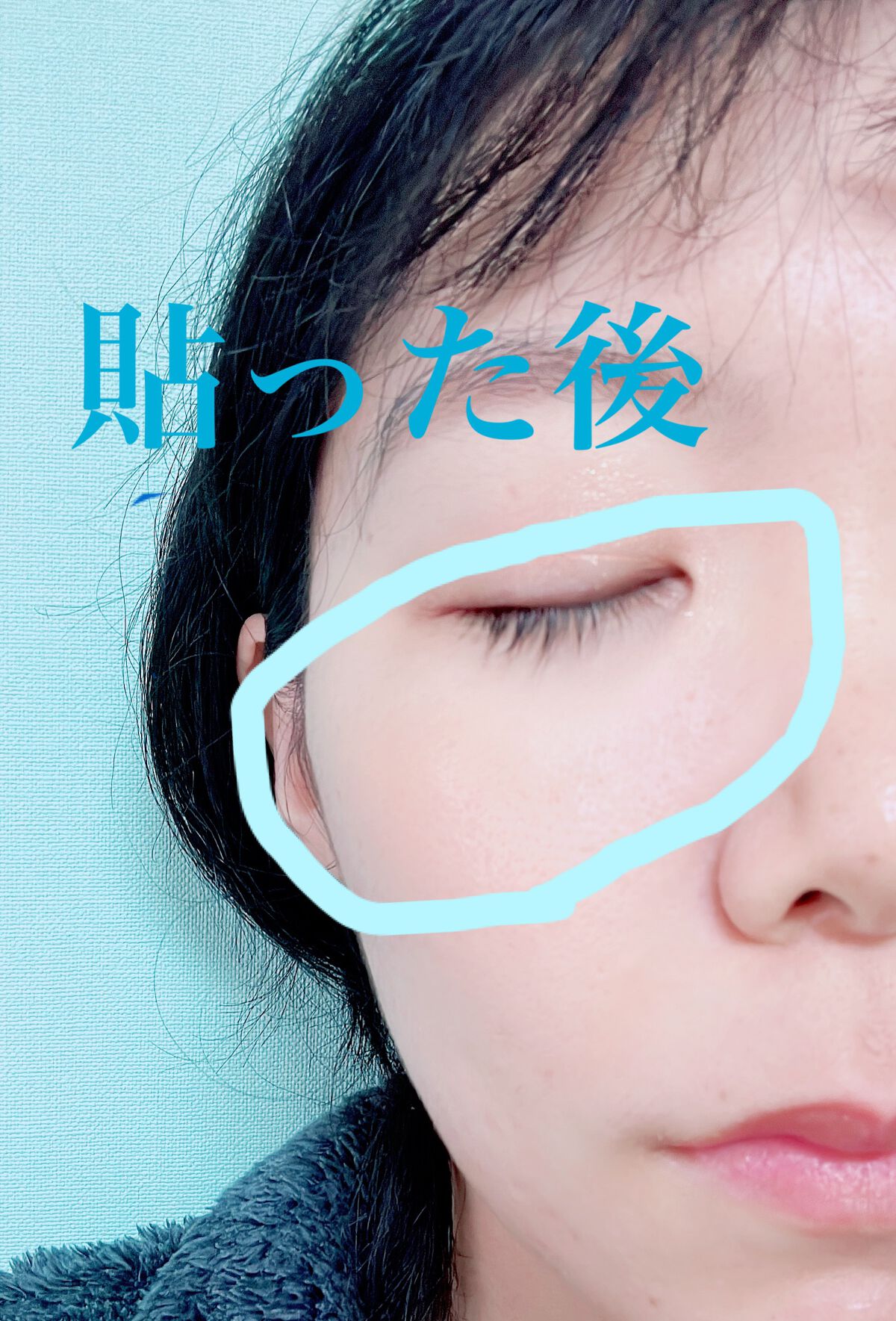 リクエス コンセントレート チャージ パッチ/クラブ/シートマスク・パックを使ったクチコミ(5枚目)