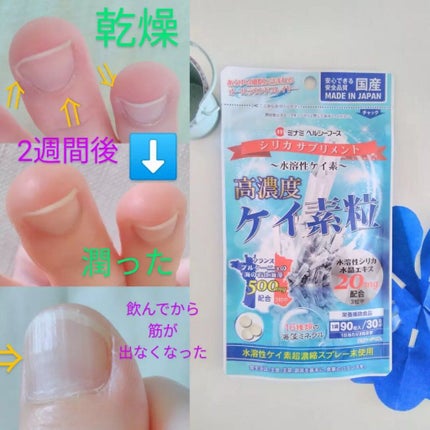 高濃度ケイ素粒/ミナミヘルシーフーズ/健康サプリメントを使ったクチコミ(1枚目)