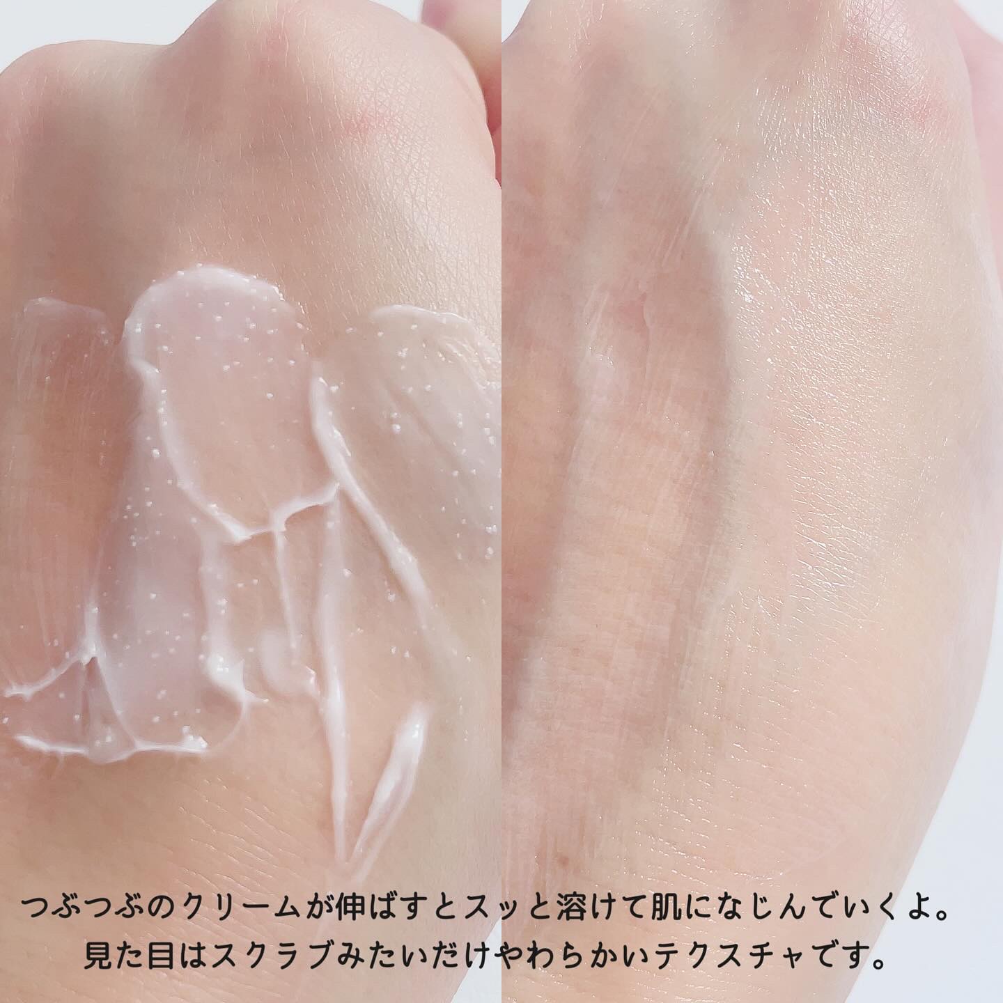 アトバリア365クリーム/AESTURA/フェイスクリームを使ったクチコミ（3枚目）