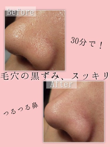 Pore control Blackhead off sheet ビューティシート/Ciracle/シートマスク・パックを使ったクチコミ（1枚目）