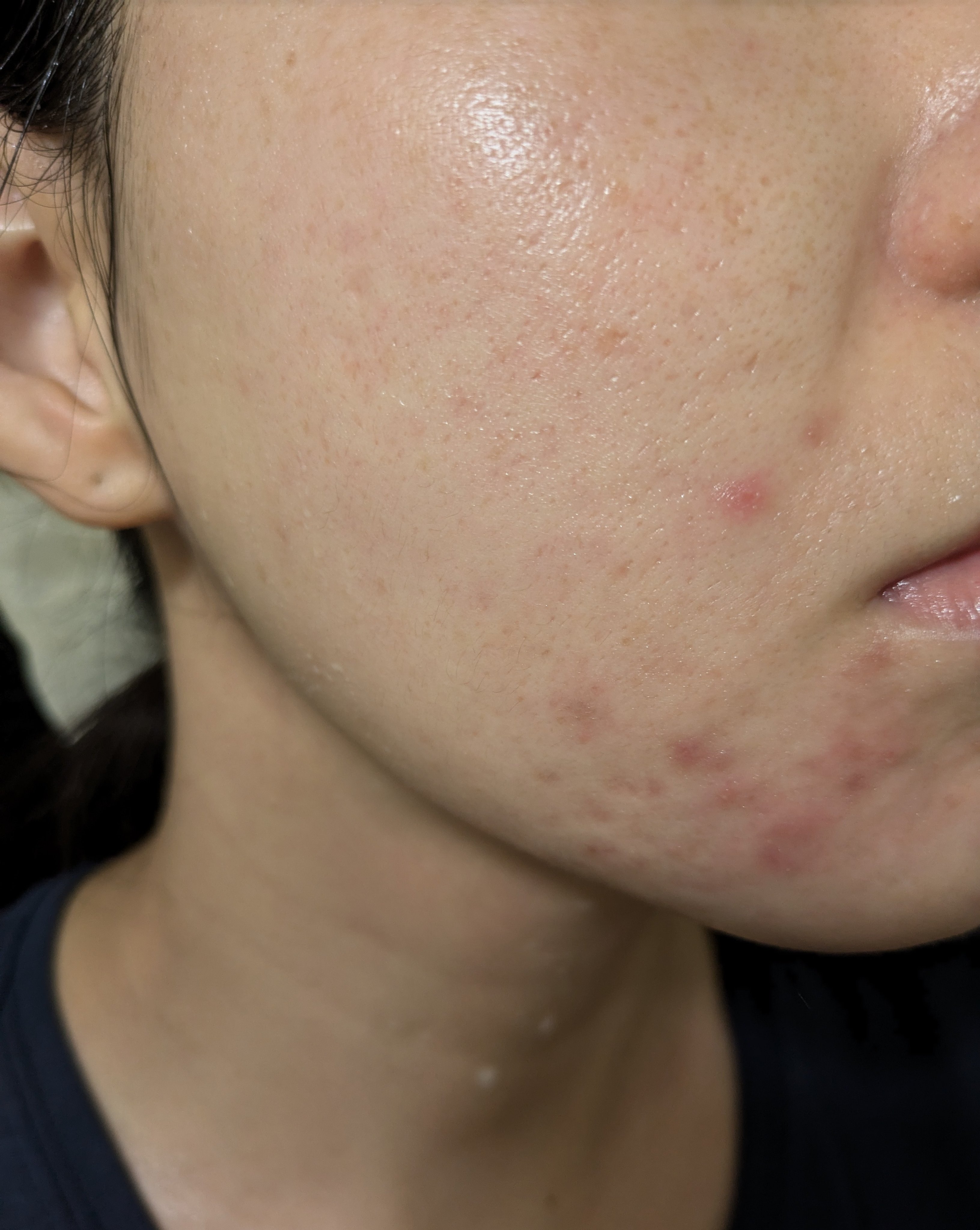 11/15の#汚肌工事録