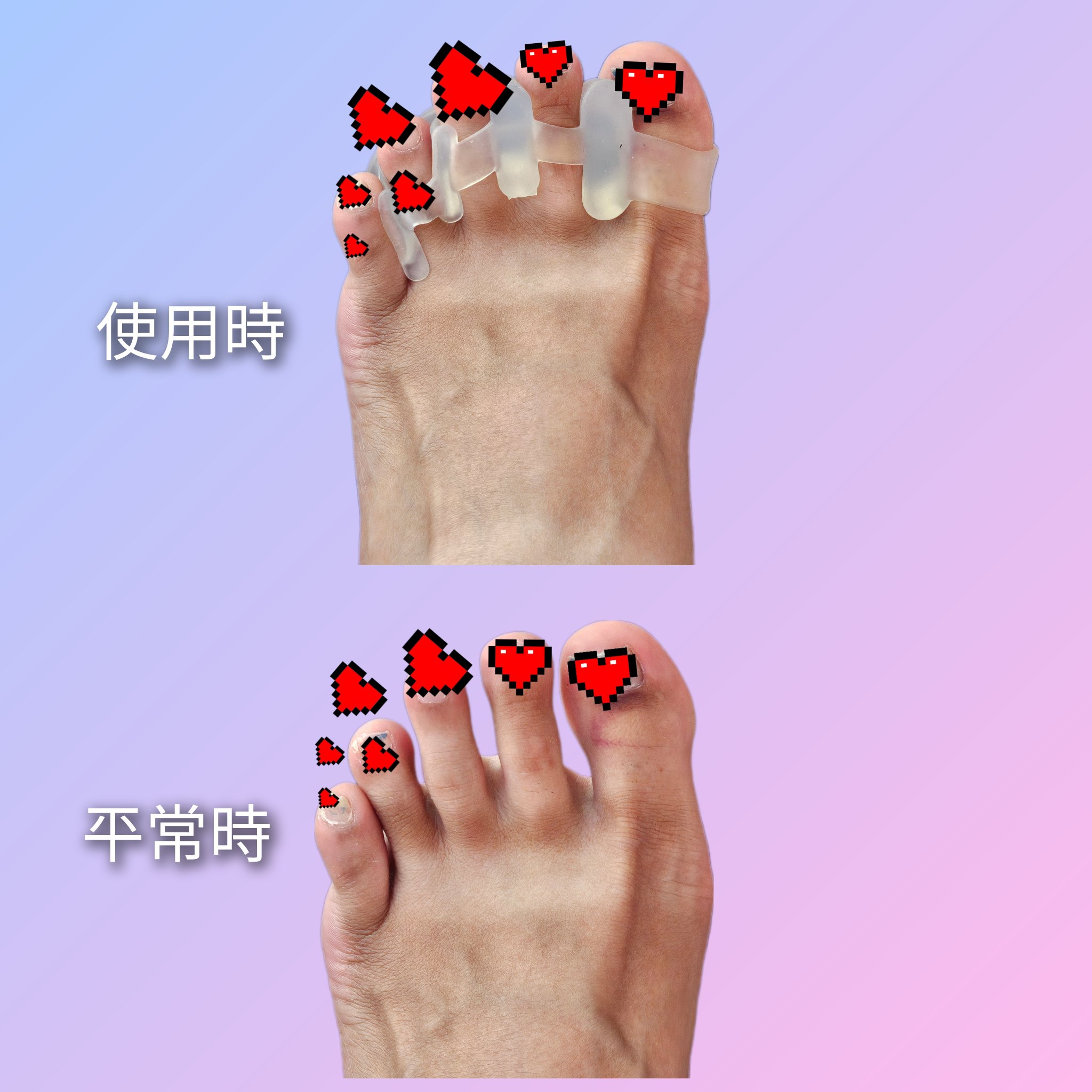 足指サポーター/potegar/その他を使ったクチコミ（3枚目）