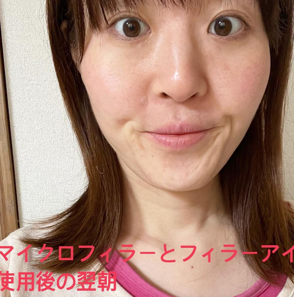レッドパワー セラム/アイビー/美容液を使ったクチコミ(8枚目)
