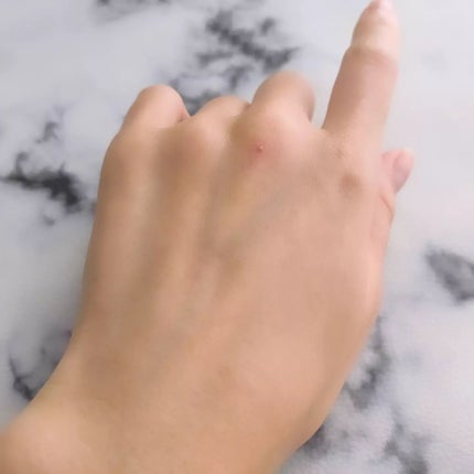 シューマジゴールド糸リフティングクリーム+EMS美顔器/MEDITHERAPY/フェイスクリームを使ったクチコミ(9枚目)