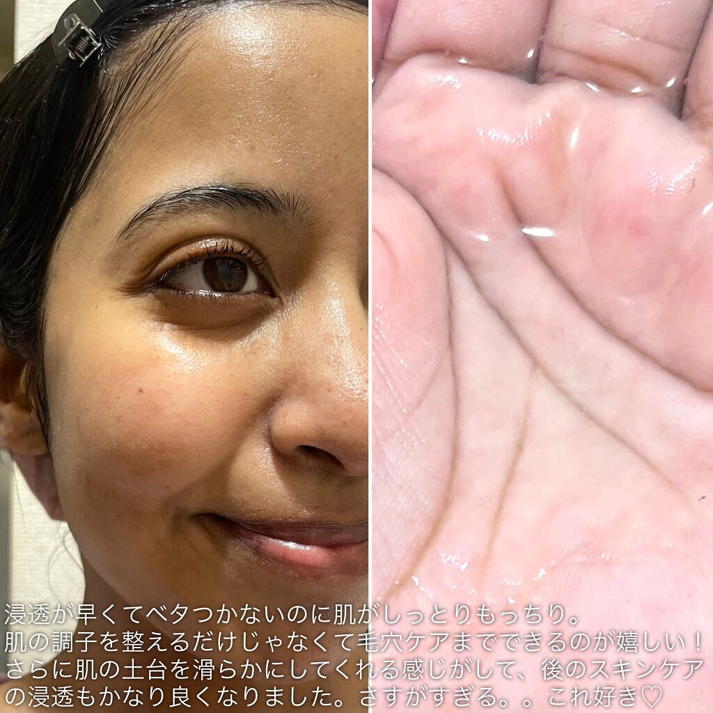 クインス ローション/Quince/化粧水を使ったクチコミ(6枚目)