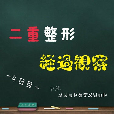 4日目です🚩

ほぼ安定してきて、今日はコンタクトも付けて生活しました✨(まつ毛も上げちゃって)

ゴロゴロ感や不快感も完全に無くなり、完全に自分の目って感じです✌

埋没法二重整形をして感じたメリット