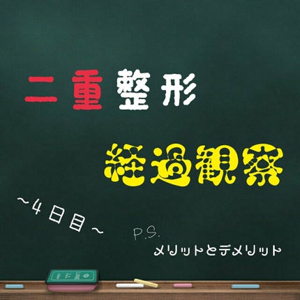 二重整形/その他を使ったクチコミ(1枚目)