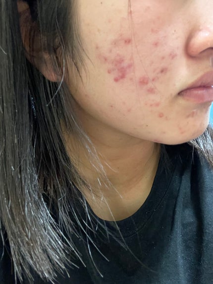 を使ったクチコミ(2枚目)