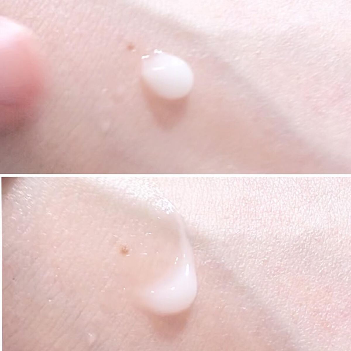 マデカソサイド&アラントインクリーム/Frankly/フェイスクリームを使ったクチコミ（2枚目）