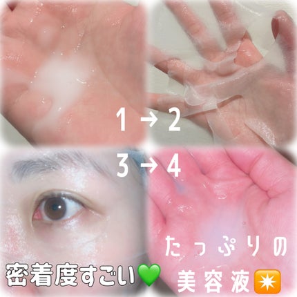 リードルS 300 2ステップマスク/VT/シートマスク・パックを使ったクチコミ(4枚目)