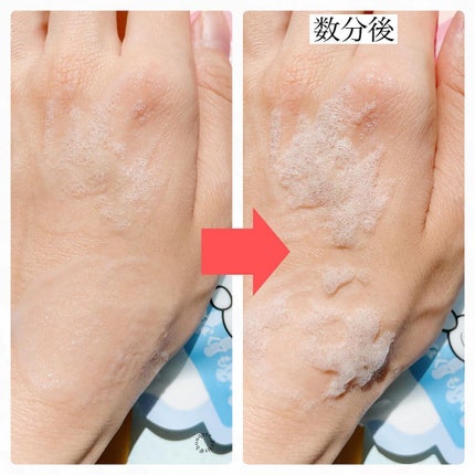 マジックバブルエッセンスパックMINI/BAKER7/シートマスク・パックを使ったクチコミ(5枚目)