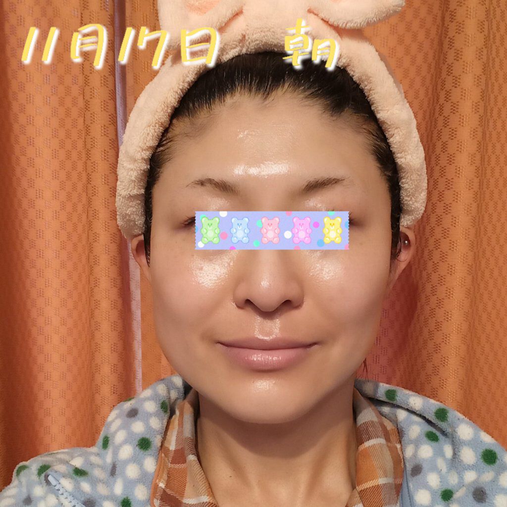 レチノールA 1% アドバンスドリバイタリゼーションクリーム/Life-flo/フェイスクリームを使ったクチコミ（1枚目）