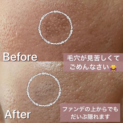 スポットイレイサーコンシーラーペンシル/MustaeV/ペンシルコンシーラーを使ったクチコミ(4枚目)