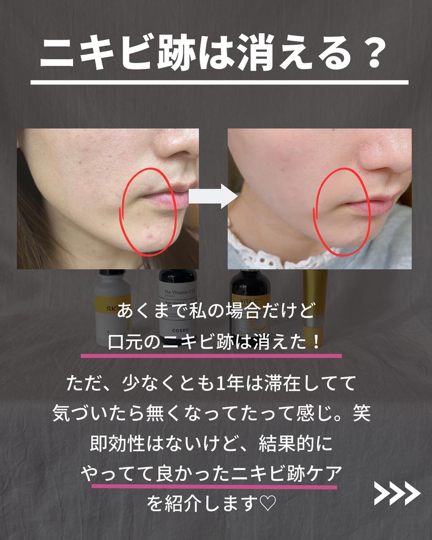 かほ|インスタ6.2万人 on LIPS 「@kaho.skincare▷乾燥肌の神コスパスキンケア♡こ..」(2枚目)