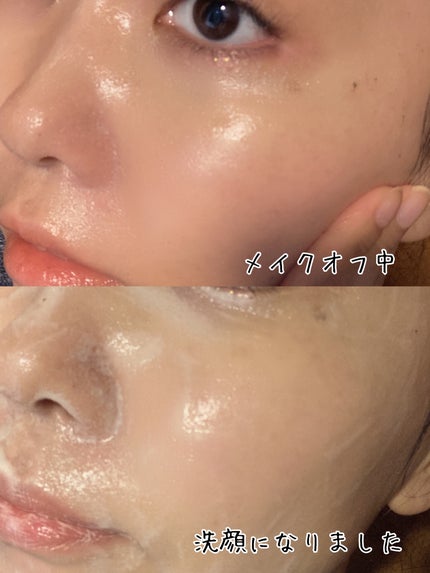 ロータスクレンジングジェル/エルツティン/クレンジングジェルを使ったクチコミ(5枚目)