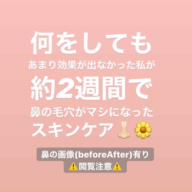 《何をしてもあまり効果が出なかった私が約2週間のスキンケアで鼻の毛穴がマシになったスキンケア》
✼••┈┈┈┈••✼••┈┈┈┈••✼
皆さんこんにちは！！
・
今回はずっと気になってた精製水を2週間使