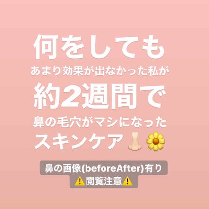 乳液・敏感肌用・しっとりタイプ/無印良品/乳液を使ったクチコミ(1枚目)