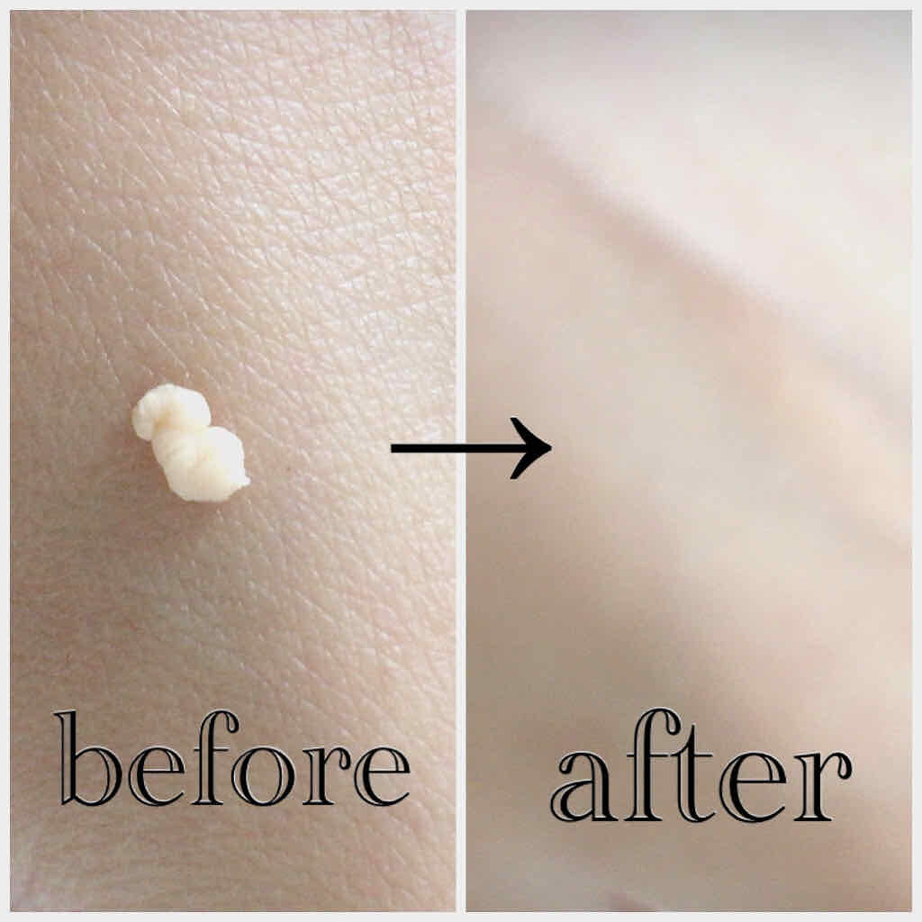 ETUDE フィックス＆フィックス プライマーのクチコミ「#ETUDE HOUSE #FIX and FIX PRIMER
#化粧下地#毛穴凹凸カバー#.....」（2枚目）