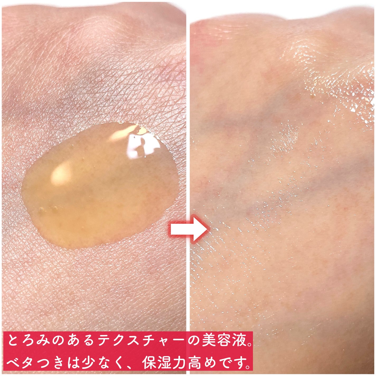 レッドアクネピーリングセラム/MEDICUBE/美容液を使ったクチコミ(8枚目)