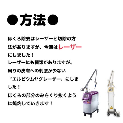 Kana on LIPS 「マスク解禁前にほくろとおさらば!!ほくろ除去レポです🙌まだ除去..」(3枚目)