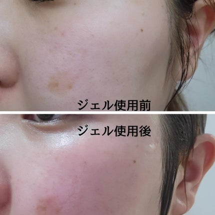 ホットクレンジングジェル/skinvill/クレンジングジェルを使ったクチコミ(6枚目)