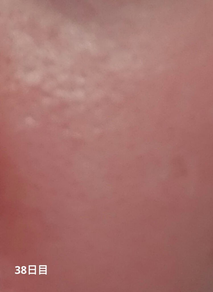 ミラミックス/ZO Skin Health/フェイスクリームを使ったクチコミ（3枚目）