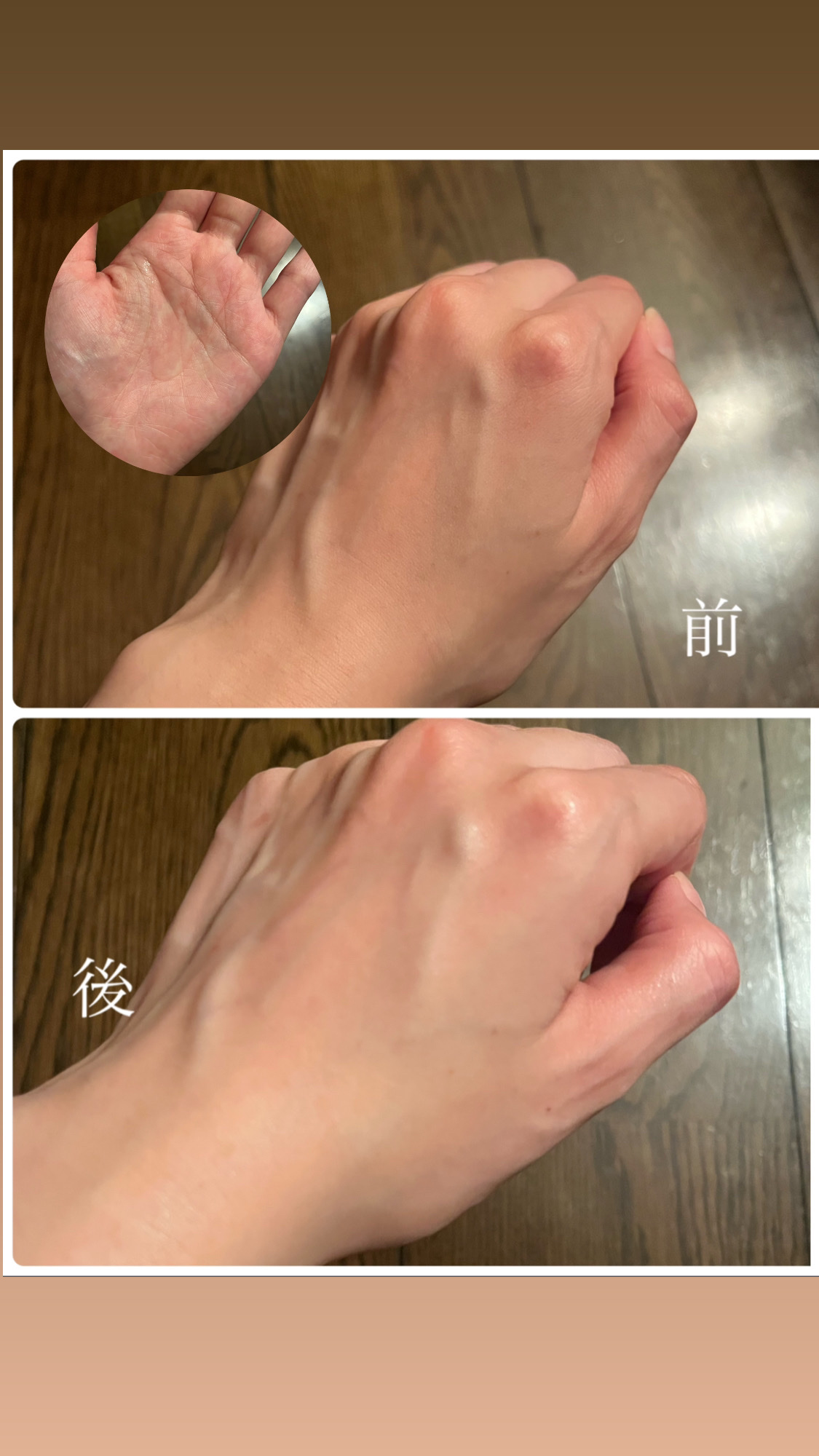 バリアサイクルトナー/P.CALM/化粧水を使ったクチコミ（2枚目）