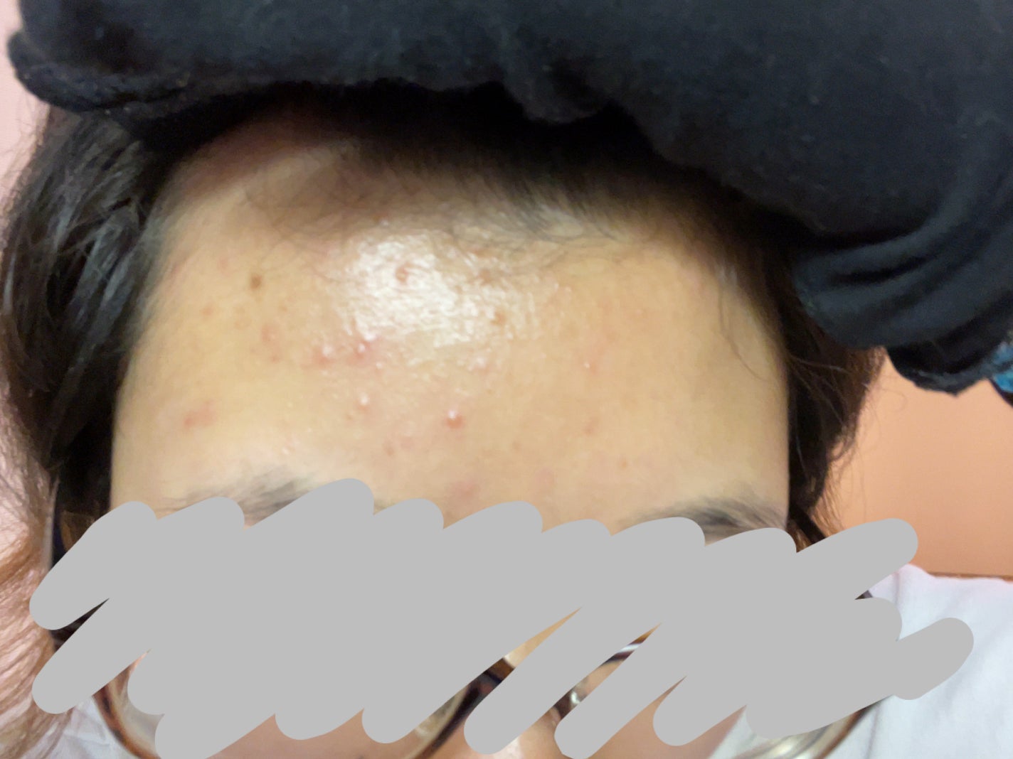 薬用しみ対策 美白化粧水/メラノCC/化粧水を使ったクチコミ(2枚目)