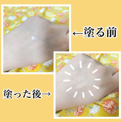 メディカルクリームc(医薬品)/メンソレータム アクネス25/その他を使ったクチコミ(3枚目)