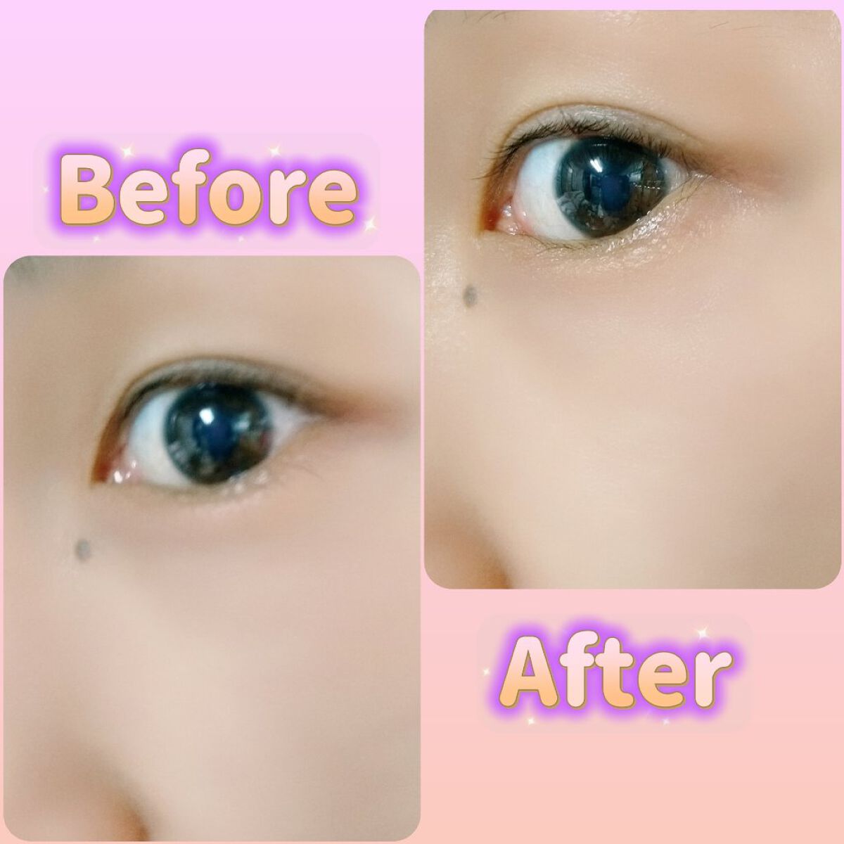 ジュエリアプレミアム マイクロパッチ/ジュエリアプレミアム/シートマスク・パックを使ったクチコミ（3枚目）