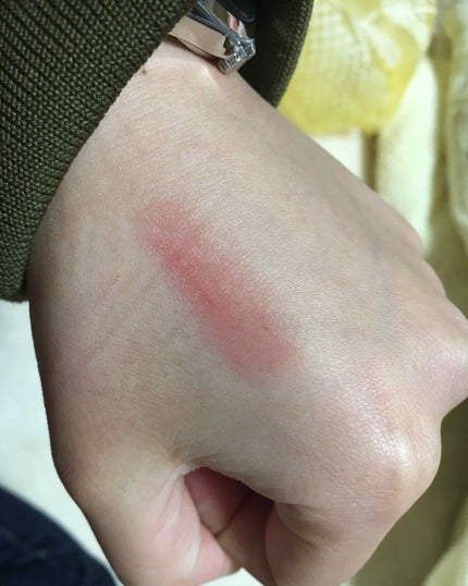 濃密うるみカラーリップクリーム レッド/DHC/リップクリームを使ったクチコミ(2枚目)