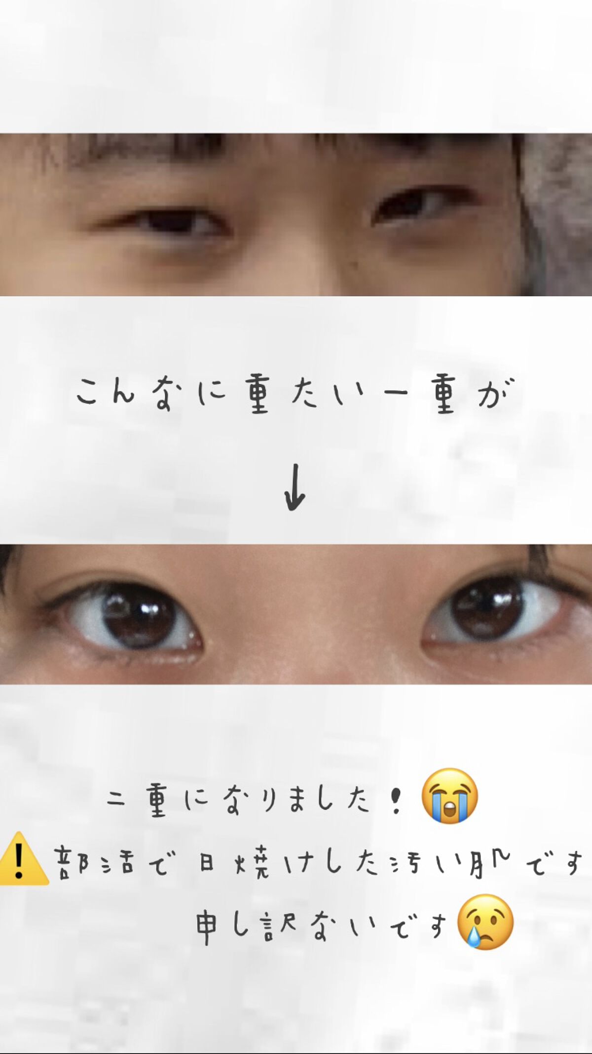 アイトーク スーパーホールド/アイトーク/二重まぶた用アイテムを使ったクチコミ（2枚目）