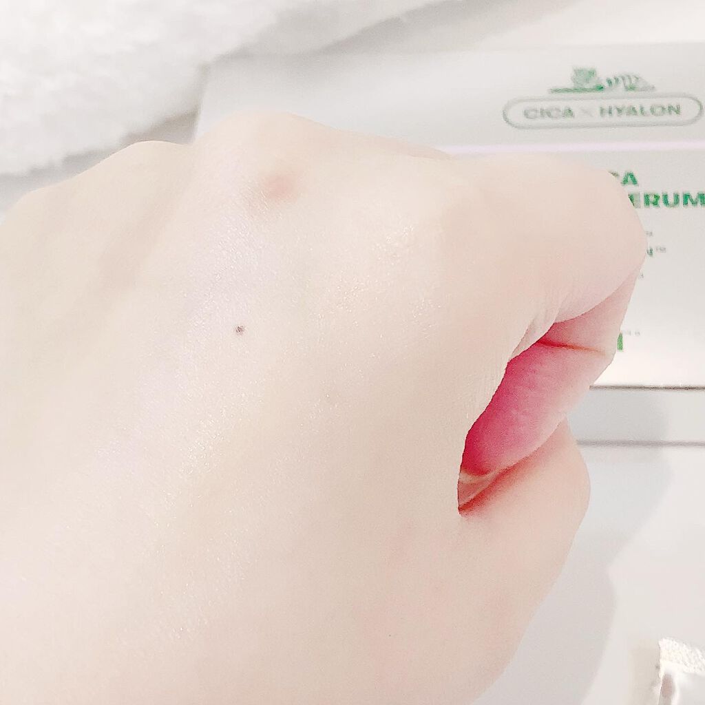 CICA リニューセラム/VT/美容液を使ったクチコミ(8枚目)