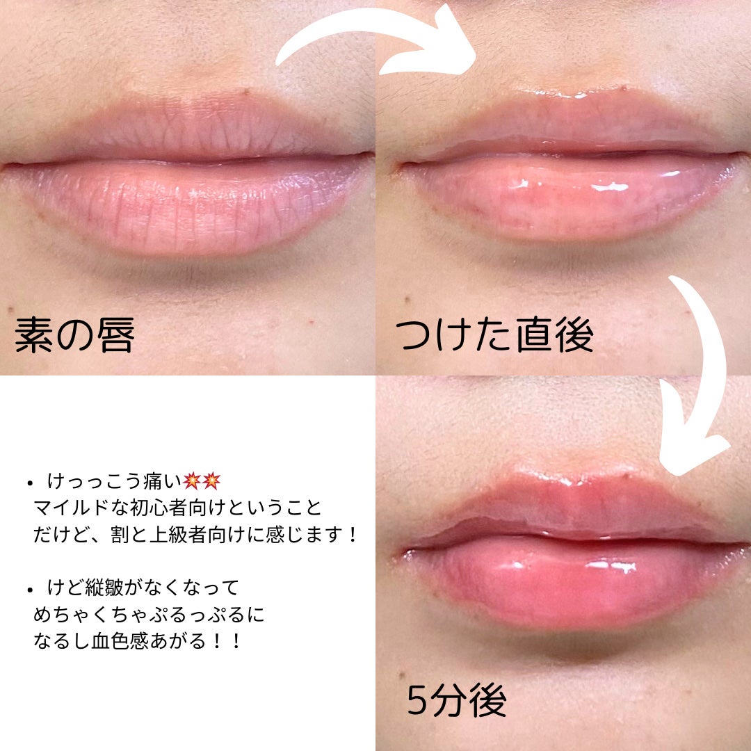 ウォーターフルリッププランパー/COSNORI/リッププランパーを使ったクチコミ(4枚目)