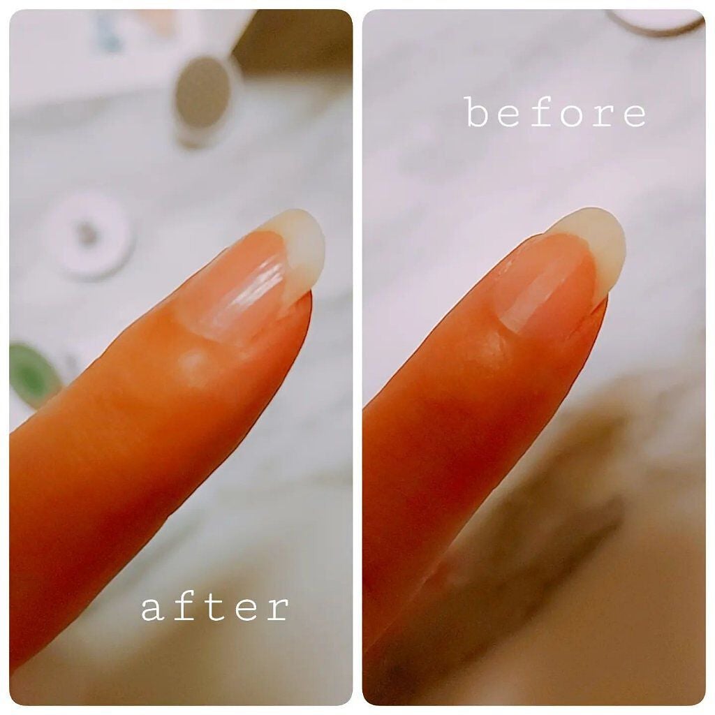 小石川恋【フォロバします】 on LIPS 「商品名:電動ネイルケアマシンブランド:nizmir電動でネイル..」(3枚目)