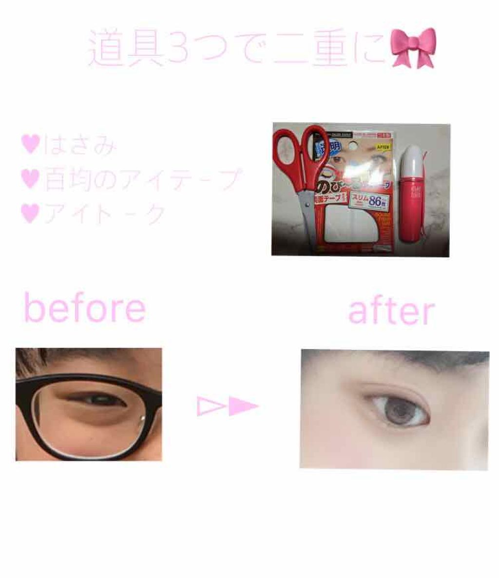 アイトーク/アイトーク/二重まぶた用アイテムを使ったクチコミ(1枚目)