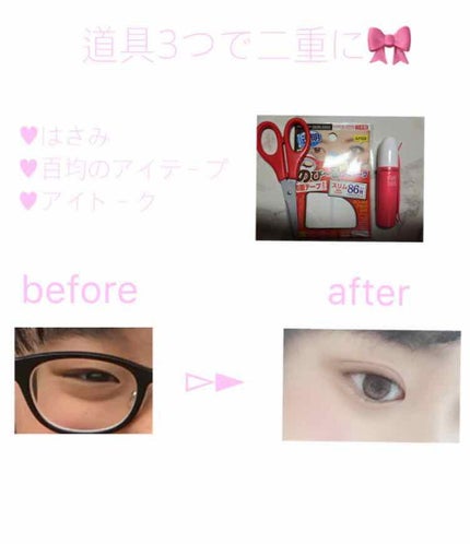 アイトーク/アイトーク/二重まぶた用アイテムを使ったクチコミ(1枚目)