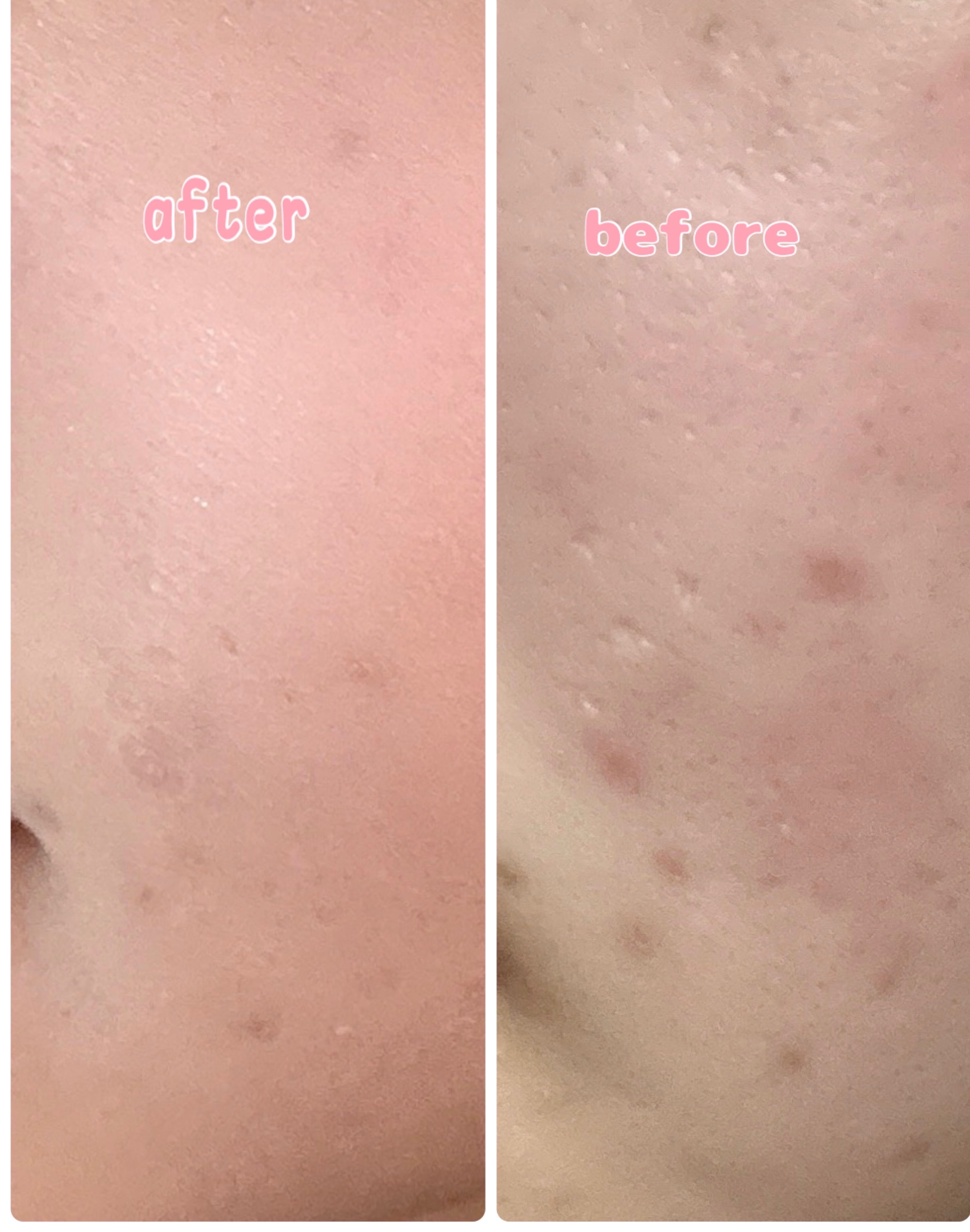 ハートリーフシーンカバークッション/23years old/クッションファンデーションを使ったクチコミ（3枚目）