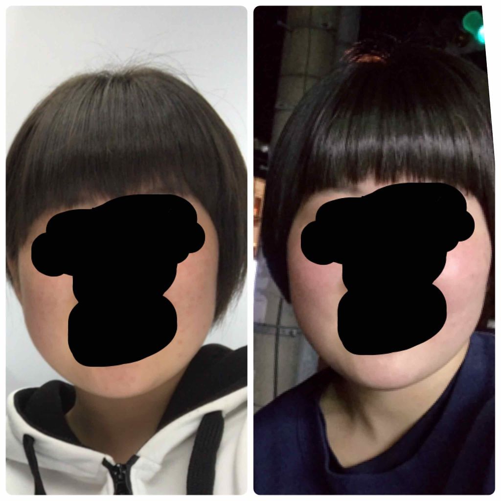 ハトムギ化粧水(ナチュリエ スキンコンディショナー R )/ナチュリエ/化粧水を使ったクチコミ(4枚目)