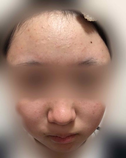 ハトムギ化粧水(ナチュリエ スキンコンディショナー R )/ナチュリエ/化粧水を使ったクチコミ(1枚目)