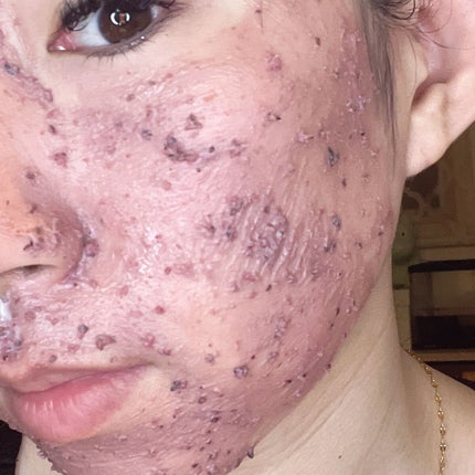 ビューティ スリープ/ラッシュ/洗い流すパック・マスクを使ったクチコミ(2枚目)