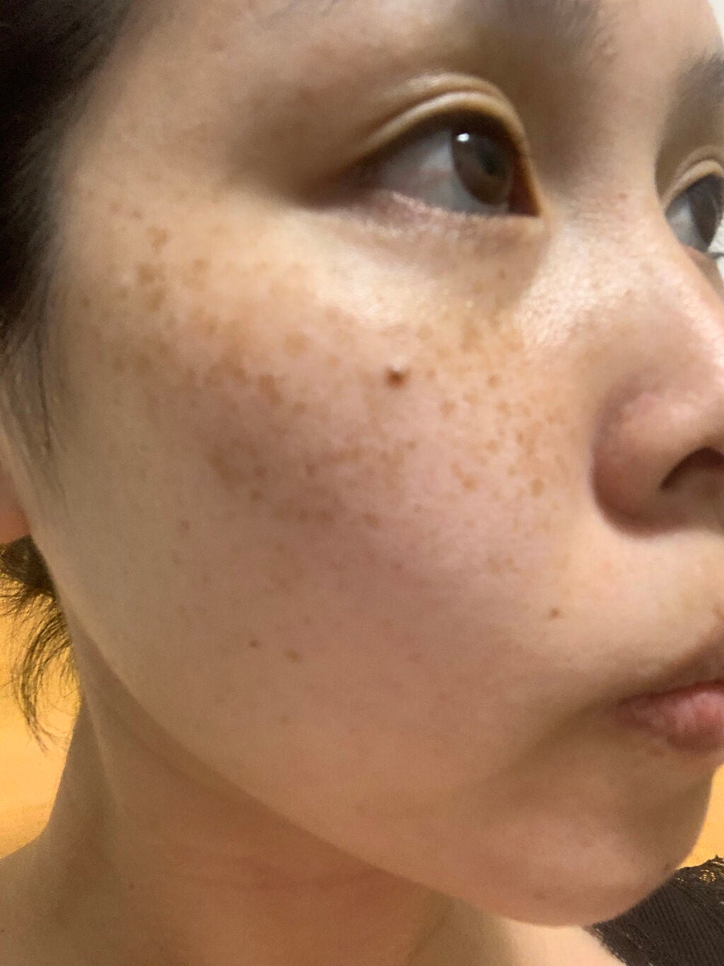 ケシミン クリームj/ケシミン/その他スキンケアを使ったクチコミ(2枚目)