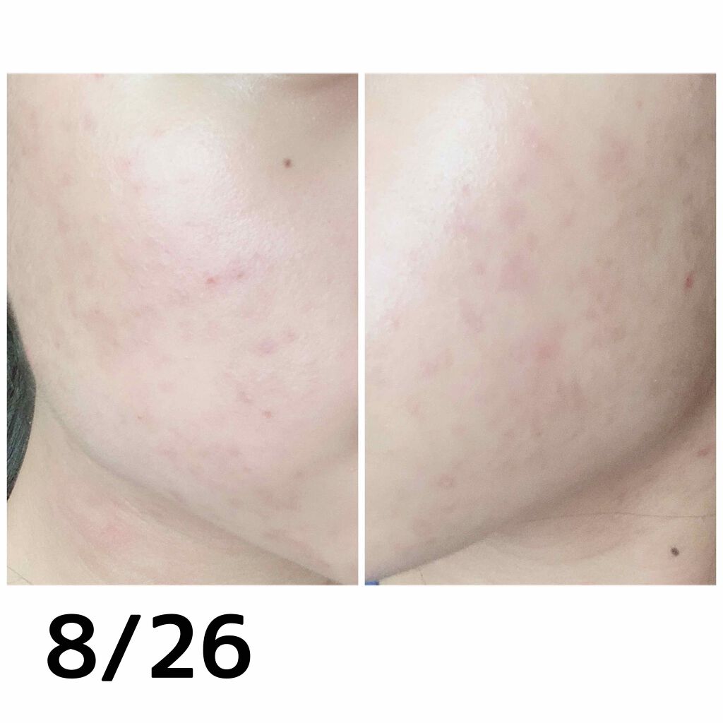 デュオ ザ クレンジングバーム/DUO/クレンジングバームを使ったクチコミ(2枚目)