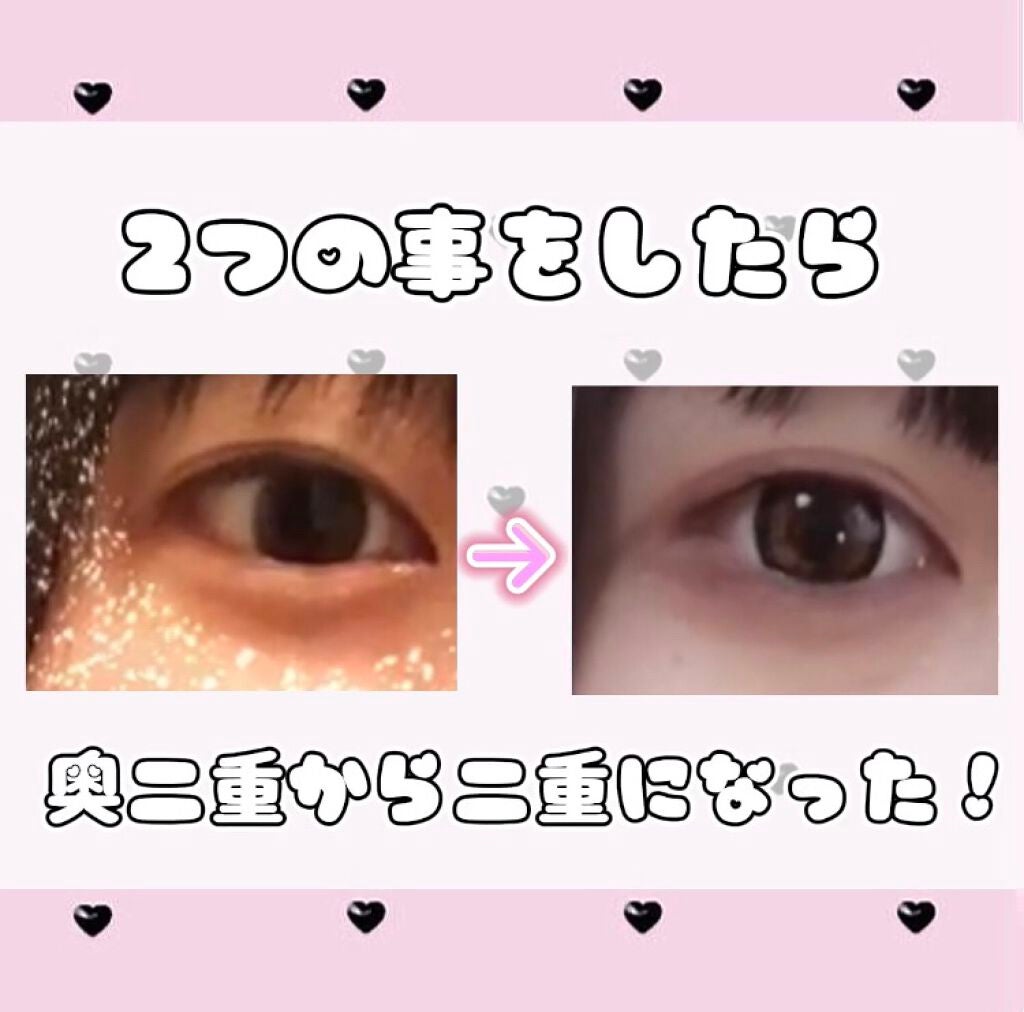 アイテープ(絆創膏タイプ、レギュラー、70枚)/DAISO/二重まぶた用アイテムを使ったクチコミ(1枚目)