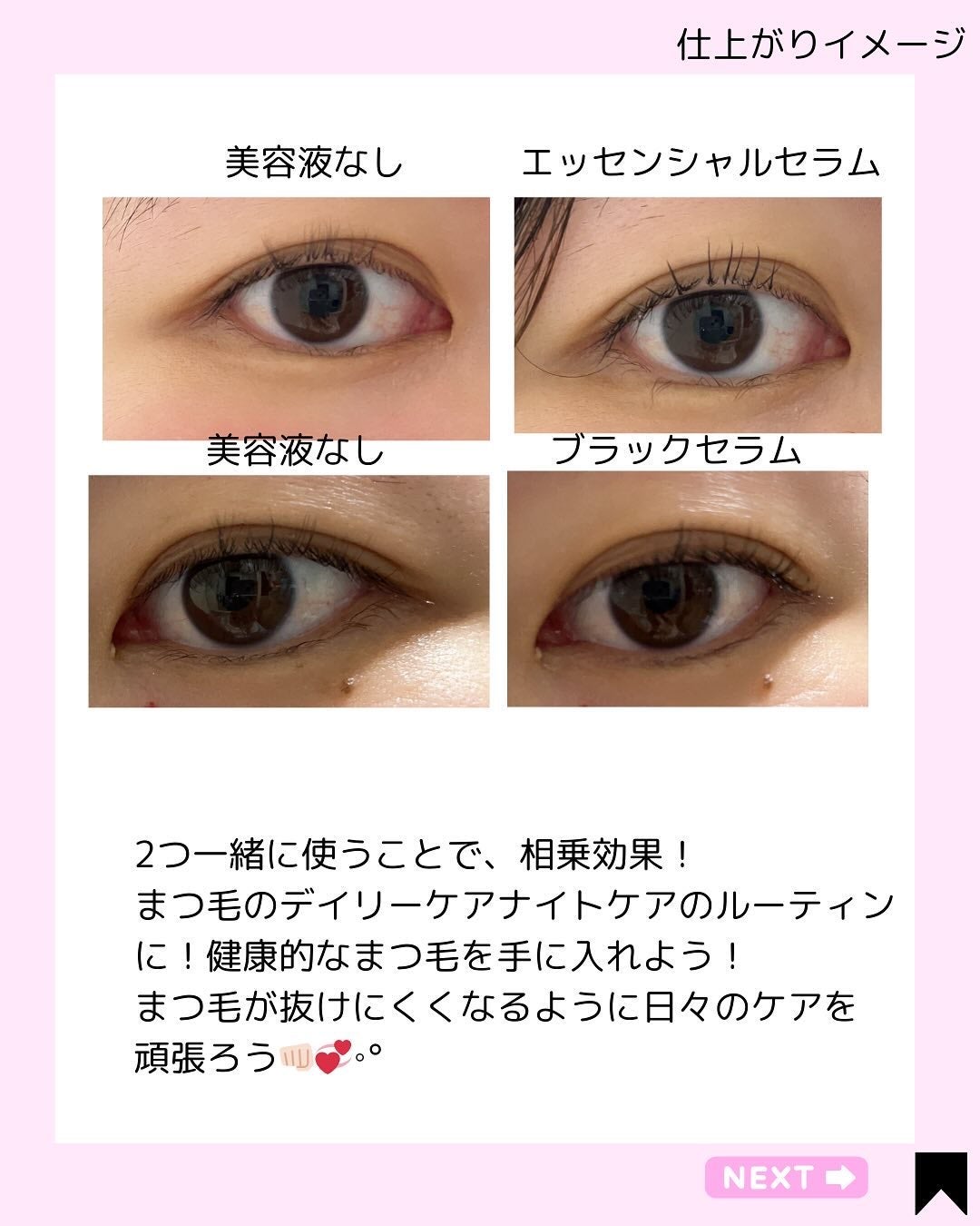 Kana on LIPS 「一緒に使って賢くマツ育♡/@kana.cosme2525他の投..」(6枚目)