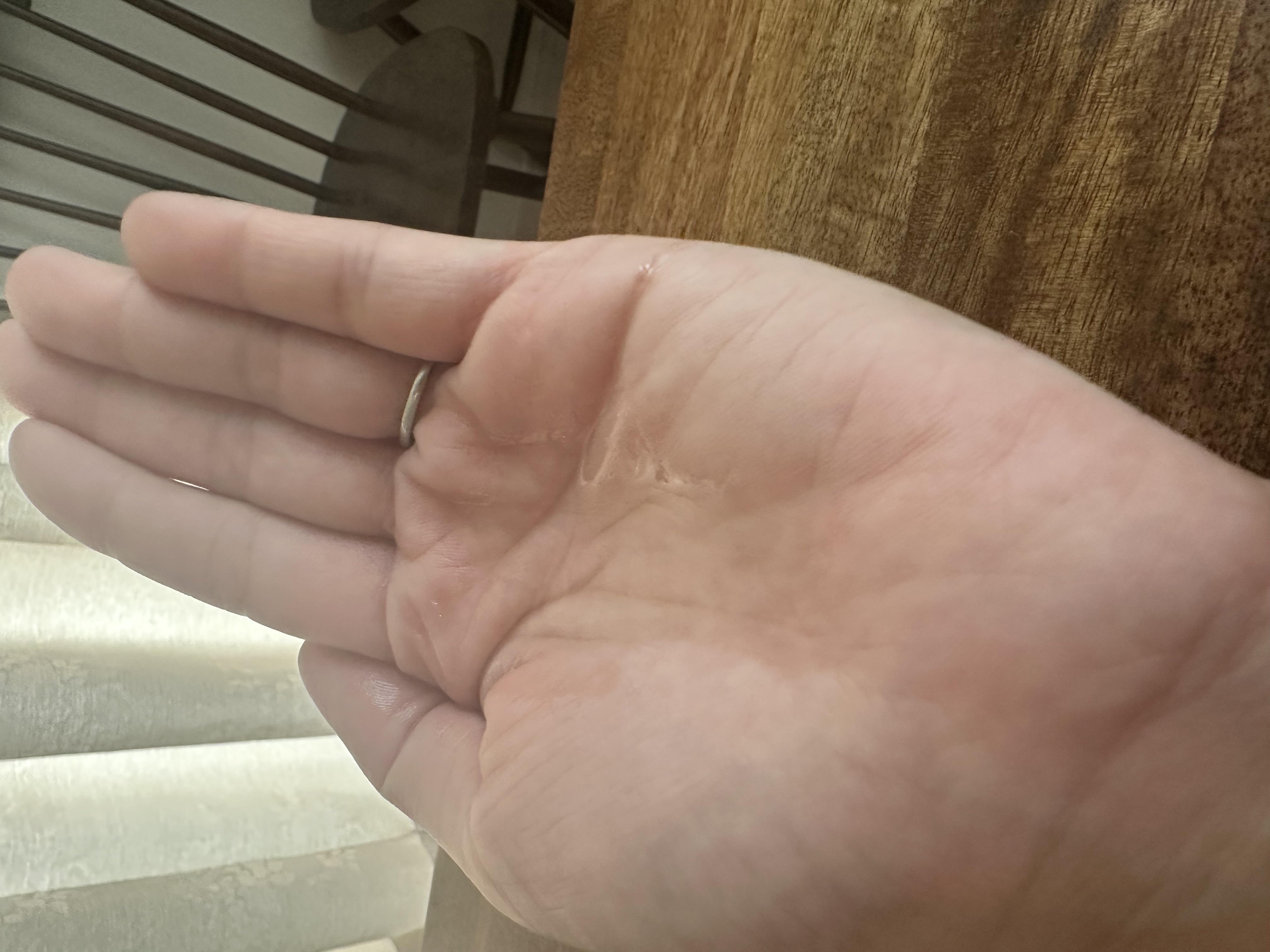 センテラ ライトクレンジングオイル/SKIN1004/オイルクレンジングを使ったクチコミ（3枚目）