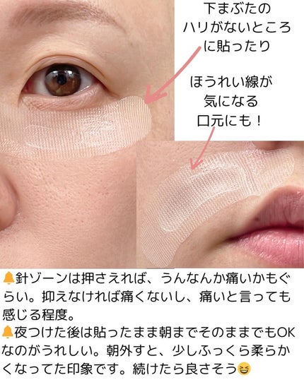 ジュエリアプレミアム マイクロパッチ/ジュエリアプレミアム/シートマスク・パックを使ったクチコミ(3枚目)